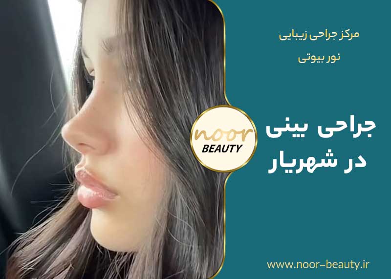 جراحی بینی در شهریار