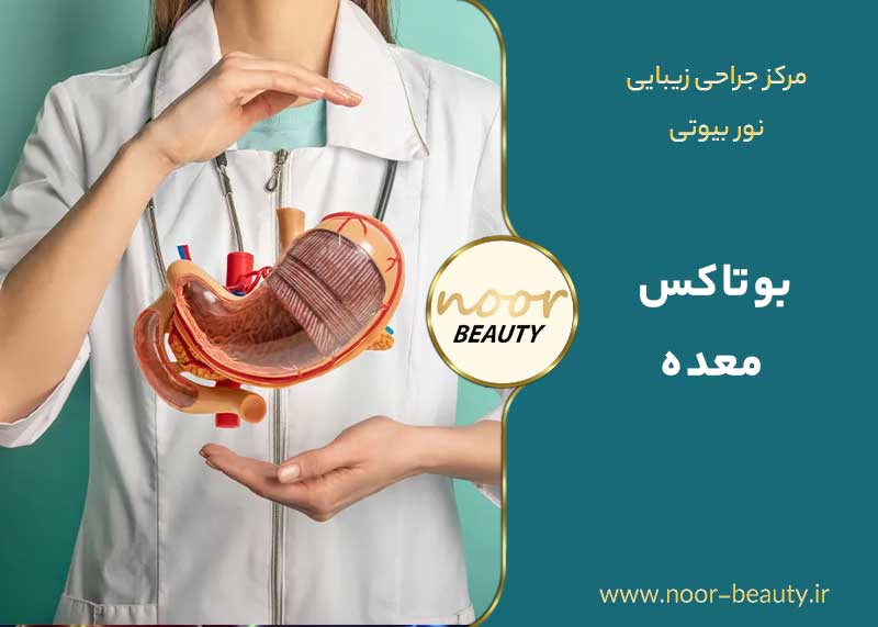 بوتاکس معده در کرج