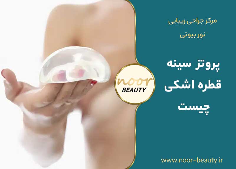 پروتز سینه قطره اشکی چیست