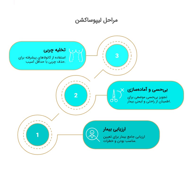 فرایند عمل جراحی لیپوساکشن ( لیپوماتیک ) در نوربیوتی​