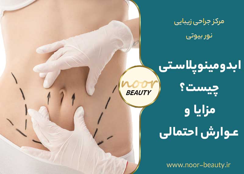 ابدومینوپلاستی چیست؟ مزایا و عوارش احتمالی
